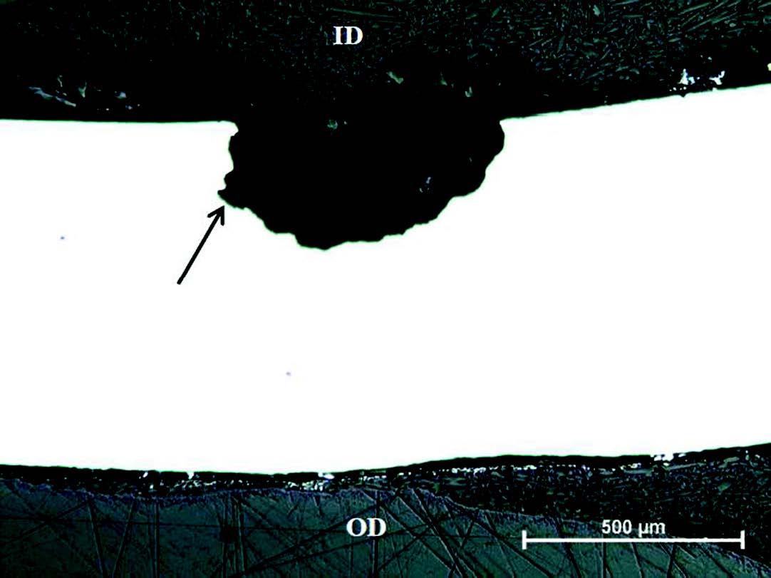 Figure 3. A transverse cross-section shows a rounded pit with some tunneling just beginning (arrow). Approximately 35% of the wall thickness has been lost at the deepest point.